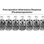 Scientists identify clues to making immunotherapy more effective against glioblastoma