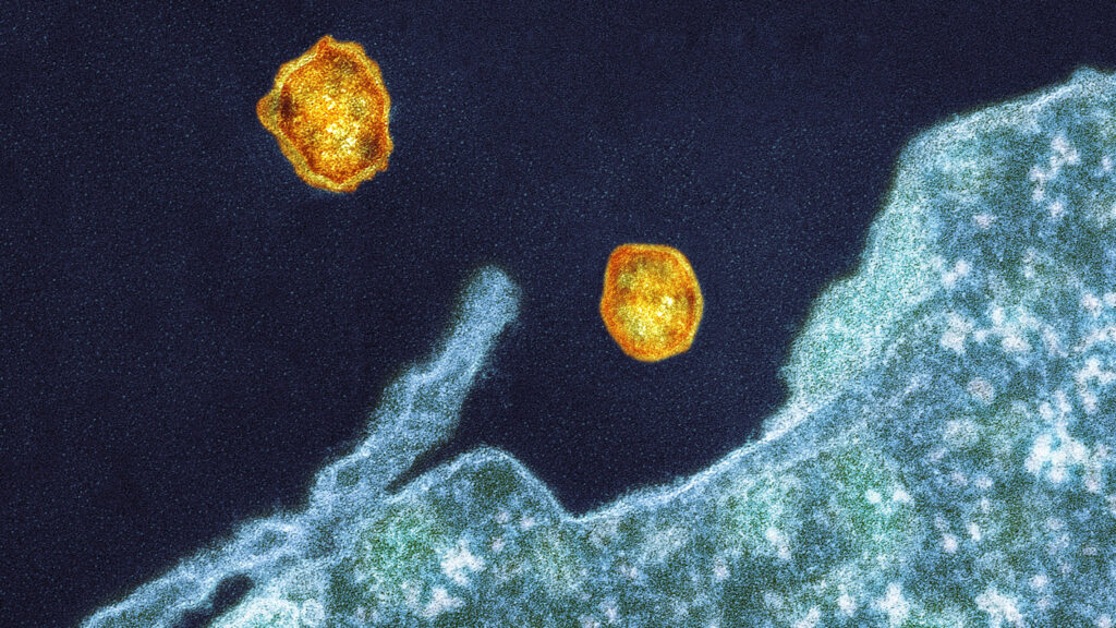 Opinion: England and other nations are on the path toward eliminating hepatitis C. Why not the U.S.?