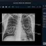 Investigating the cost-effectiveness of AI in public health
