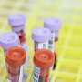 How pneumonia can reveal undiagnosed blood cancer