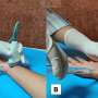 Minimally invasive technique offers lasting relief for carpal tunnel syndrome