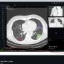 Public dataset aims to teach AI to 'show its work' on CT scans
