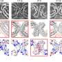 Polyubiquitin may stabilize tau filament structures in neurodegenerative diseases