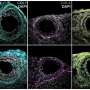 Stiffer ovarian tissue disrupts cellular connections needed for egg development, lab experiments reveal