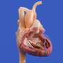 Japanese hospital performs first surgery using heart muscle stem cells