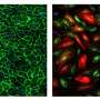 Researchers identify speed of gene transcription as a new therapeutic target for vascular disease