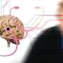 Molecular glue degraders show early promise in reducing Alzheimer's-linked brain plaques