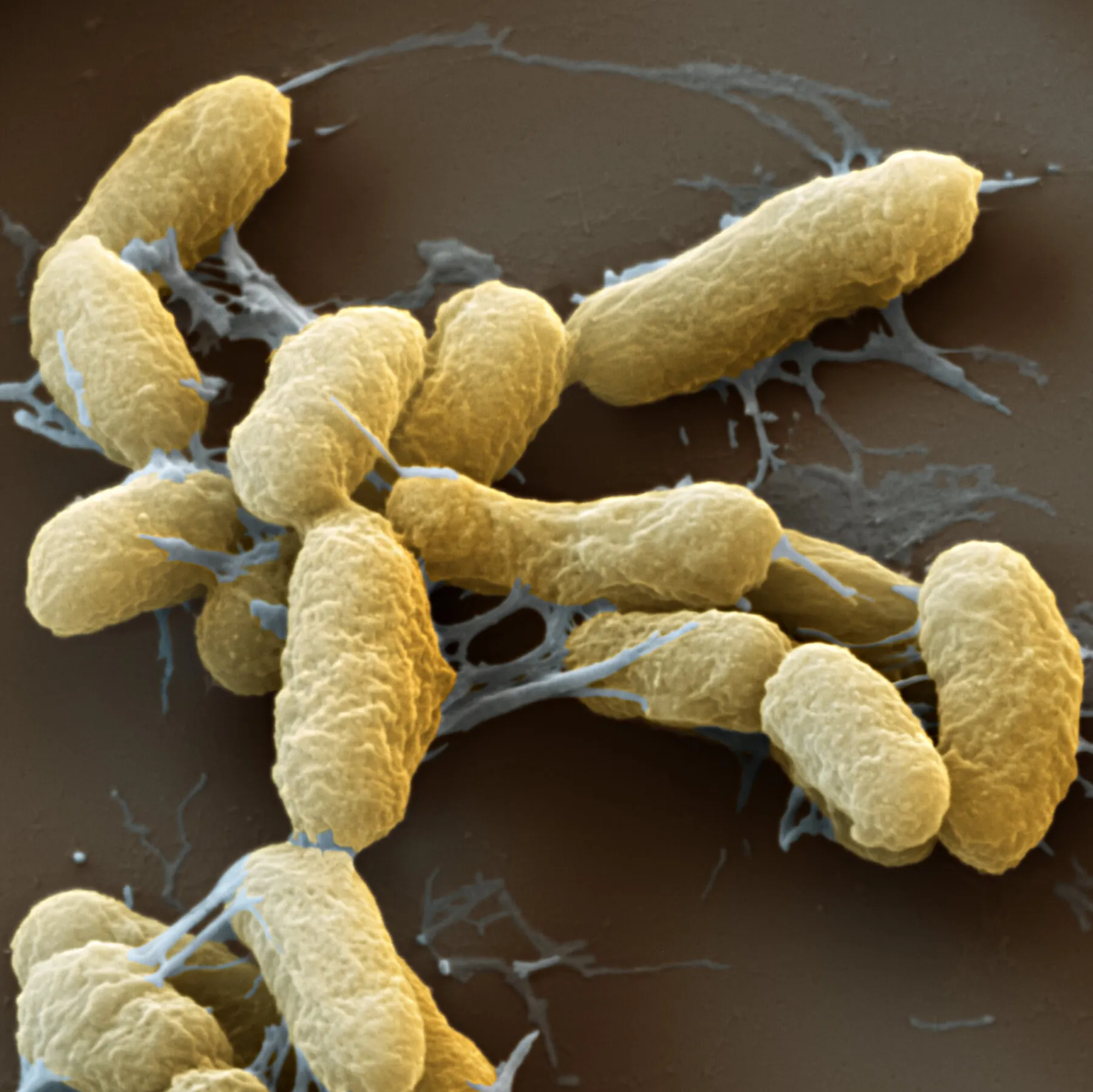 A Lab Worker’s Death Is Raising Plague Fears in Russia. What Do Experts Want to Know?