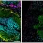 How the benefits of vaccination extend beyond protection from infection