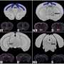 Brain circuit remembers stresses to help shape reactions to them