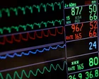 ‘Early deaths are not inevitable’: report reveals why adults with severe mental illness die younger