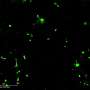 Reversible genetic switches could give cancer immunotherapy more precise control