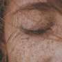 Detecting skin cancer even before it becomes visible with AI-assisted image recognition