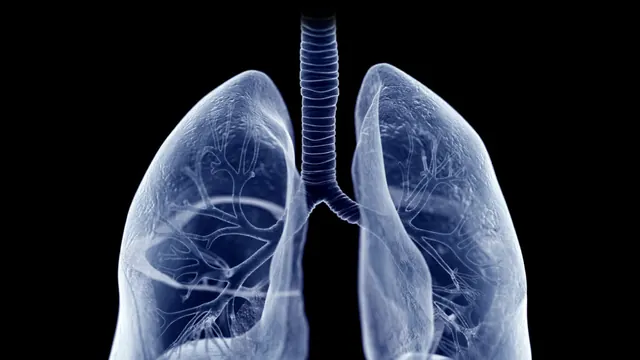 STAT+: Roivant lung disease drug hits mid-stage study goals