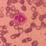 New mechanism shows how immune cells fine-tune adhesion during infection and recovery