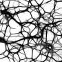Brain tissue removed during surgery reveals potential way to curb inflammation linked to Alzheimer's
