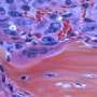 Low-cost platform maps gene activity and metabolites in the same tissue sample
