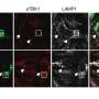 Newly discovered cell recycling pathway unlocks the therapeutic potential of TFEB