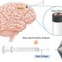 Mass spectrometry offers faster look at the edges of brain tumors