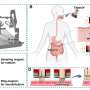 Magnetically controlled capsule shows promise for investigating hard-to-reach regions of the small intestine