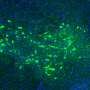 Managing misfolded proteins to prevent Parkinson's disease