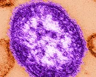 Six-week-old child in Pennsylvania died from measles, coroner says