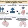 The brain still responds to favorite music in dementia